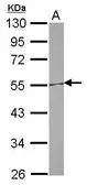 Anti-CETP antibody [N1N3] used in Western Blot (WB). GTX113162