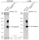 Anti-Chromogranin A antibody used in Western Blot (WB). GTX113165