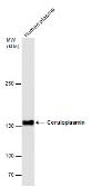 Anti-Ceruloplasmin antibody [N1N2], N-term used in Western Blot (WB). GTX113168