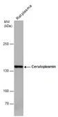 Anti-Ceruloplasmin antibody [N1N2], N-term used in Western Blot (WB). GTX113168