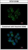 Anti-Ceruloplasmin antibody [N1N2], N-term used in Immunocytochemistry/ Immunofluorescence (ICC/IF). GTX113168