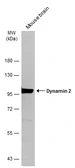 Anti-Dynamin 2 antibody [N1N3] used in Western Blot (WB). GTX113171
