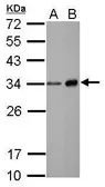 Anti-Neutrophil elastase antibody [N2C3] used in Western Blot (WB). GTX113175