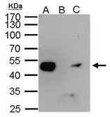 Anti-ENO1 antibody used in Immunoprecipitation (IP). GTX113179