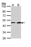 Anti-GATA1 antibody [N1C1] used in Western Blot (WB). GTX113193