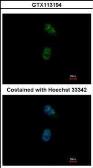 Anti-GATA4 antibody used in Immunocytochemistry/ Immunofluorescence (ICC/IF). GTX113194