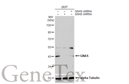 Anti-GNAS antibody [C2C3-2], C-term used in Western Blot (WB). GTX113200