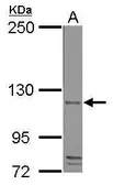 Anti-CD42b antibody used in Western Blot (WB). GTX113202