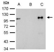 Anti-Glucocorticoid Receptor antibody used in Immunoprecipitation (IP). GTX113208