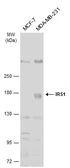 Anti-IRS1 antibody [C2C3], C-term used in Western Blot (WB). GTX113213