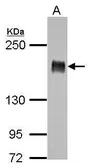 Anti-IRS1 antibody [C2C3], C-term used in Western Blot (WB). GTX113213