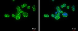 Anti-CD11a antibody [N1N3] used in Immunocytochemistry/ Immunofluorescence (ICC/IF). GTX113214