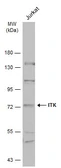 Anti-ITK antibody [N3C3] used in Western Blot (WB). GTX113215