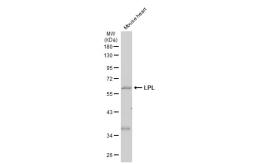 Anti-LPL antibody [N2C2], Internal used in Western Blot (WB). GTX113223
