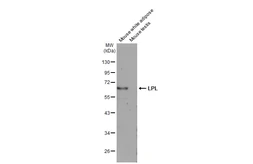 Anti-LPL antibody [N2C2], Internal used in Western Blot (WB). GTX113223