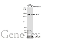 Anti-MYH9 antibody [N1-2], N-term used in Western Blot (WB). GTX113236