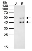 Anti-PBX1 antibody used in Immunoprecipitation (IP). GTX113242