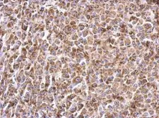 Anti-Prohibitin antibody used in IHC (Paraffin sections) (IHC-P). GTX113243