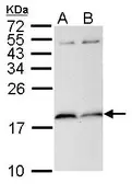 Anti-PIN1 antibody [N1C3-2] used in Western Blot (WB). GTX113245