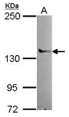 Anti-DNA polymerase gamma antibody [N1N2], N-term used in Western Blot (WB). GTX113247