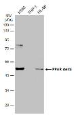 Anti-PPAR delta antibody [N2C3] used in Western Blot (WB). GTX113250