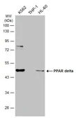 Anti-PPAR delta antibody [N2C3] used in Western Blot (WB). GTX113250