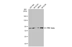 Anti-PKC beta antibody used in Western Blot (WB). GTX113252