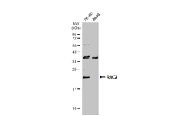 Anti-RAC2 antibody [N1C3] used in Western Blot (WB). GTX113262