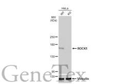 Anti-ROCK1 antibody [N1N2], N-term used in Western Blot (WB). GTX113266