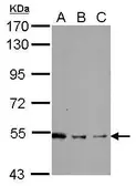 Anti-SHC1 antibody [N3C2], Internal used in Western Blot (WB). GTX113267