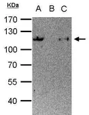 Anti-STAT6 antibody used in Immunoprecipitation (IP). GTX113273