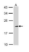 Anti-TIA1 antibody [N1N3] used in Western Blot (WB). GTX113280