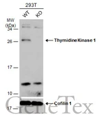 Anti-Thymidine Kinase 1 antibody used in Western Blot (WB). GTX113281