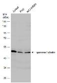 Anti-gamma Tubulin antibody used in Western Blot (WB). GTX113286