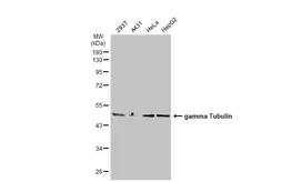 Anti-gamma Tubulin antibody used in Western Blot (WB). GTX113286