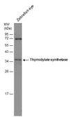 Anti-Thymidylate synthase antibody [N3C3] used in Western Blot (WB). GTX113289