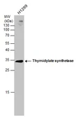 Anti-Thymidylate synthase antibody [N3C3] used in Western Blot (WB). GTX113289