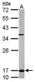 Anti-UBE2N antibody used in Western Blot (WB). GTX113290