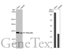 Anti-Vinculin antibody [N1N3] used in Western Blot (WB). GTX113294
