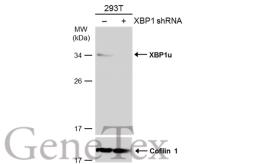 Anti-XBP1 antibody [N1C3] used in Western Blot (WB). GTX113295