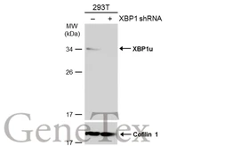 Anti-XBP1 antibody [N1C3] used in Western Blot (WB). GTX113295