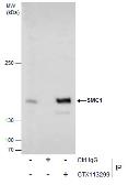Anti-SMC1A antibody used in Immunoprecipitation (IP). GTX113299
