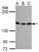 Anti-SMC1A antibody used in Western Blot (WB). GTX113299