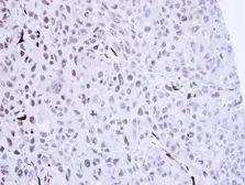 Anti-SMC1A antibody used in IHC (Paraffin sections) (IHC-P). GTX113299