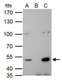 Anti-HDAC3 antibody used in Immunoprecipitation (IP). GTX113303