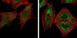 Anti-ATG5 antibody used in Immunocytochemistry/ Immunofluorescence (ICC/IF). GTX113309