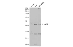 Anti-AKT3 antibody used in Western Blot (WB). GTX113312
