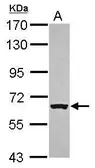 Anti-RACGAP1 antibody [C1C3] used in Western Blot (WB). GTX113322