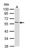 Anti-IRAK4 antibody used in Western Blot (WB). GTX113323