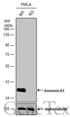 Anti-Annexin A1 antibody used in Western Blot (WB). GTX113329